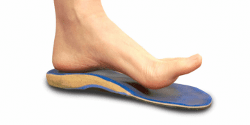 Foot orthotics and running